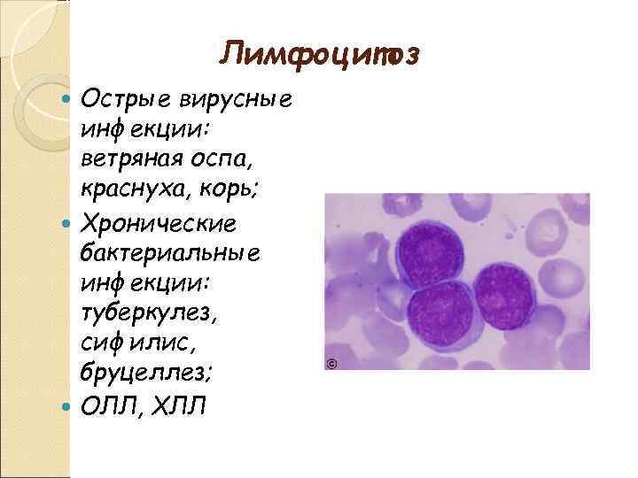 Лимфоцитоз Острые вирусные инфекции: ветряная оспа, краснуха, корь; Хронические бактериальные инфекции: туберкулез, сифилис, бруцеллез;