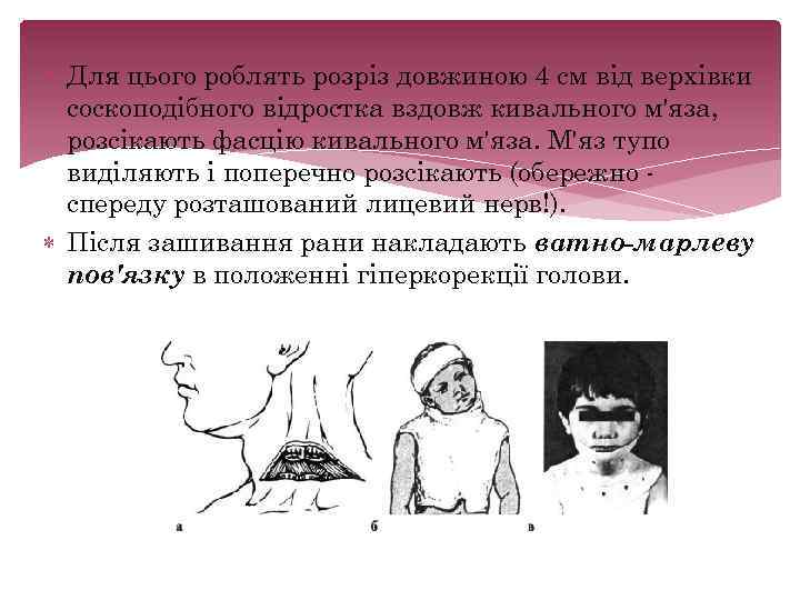  Для цього роблять розріз довжиною 4 см від верхівки соскоподібного відростка вздовж кивального