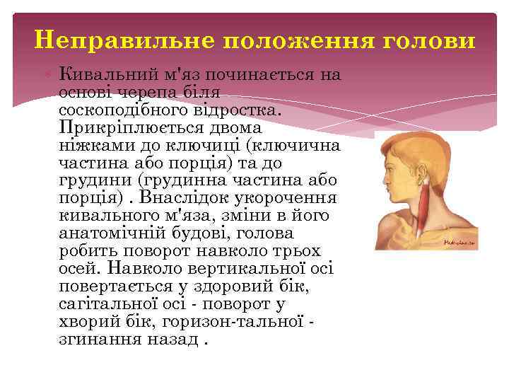 Неправильне положення голови Кивальний м'яз починається на основі черепа біля соскоподібного відростка. Прикріплюється двома