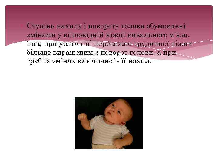  Ступінь нахилу і повороту голови обумовлені змінами у відповідній ніжці кивального м'яза. Так,