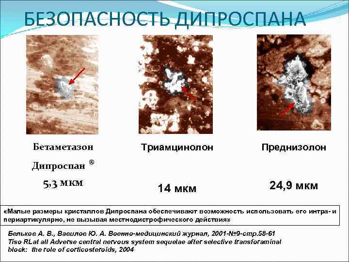БЕЗОПАСНОСТЬ ДИПРОСПАНА Бетаметазон Дипроспан 5, 3 мкм Триамцинолон Преднизолон 14 мкм 24, 9 мкм
