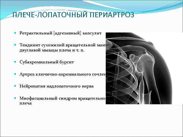 Плечевой периартрит лечение препараты. Плечелопаточный периартрит рентген. Плечелопаточный периартрит мрт. Плечевой периартрит рентген признаки. Плечелопаточный периартроз рентген.