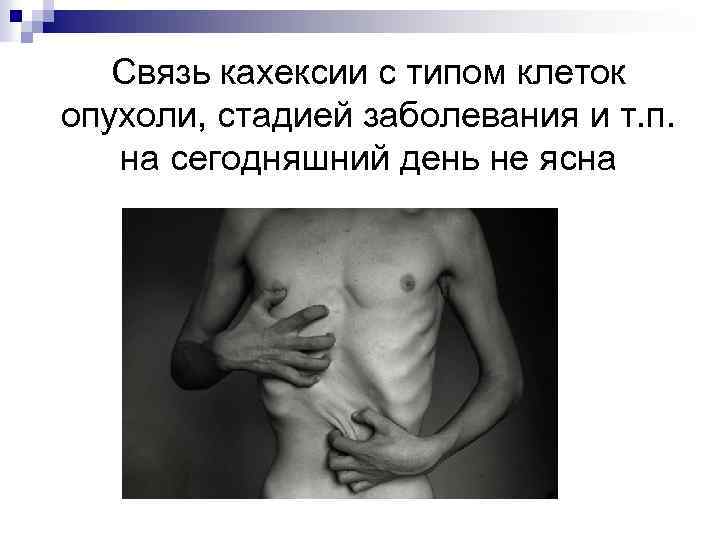 Связь кахексии с типом клеток опухоли, стадией заболевания и т. п. на сегодняшний день