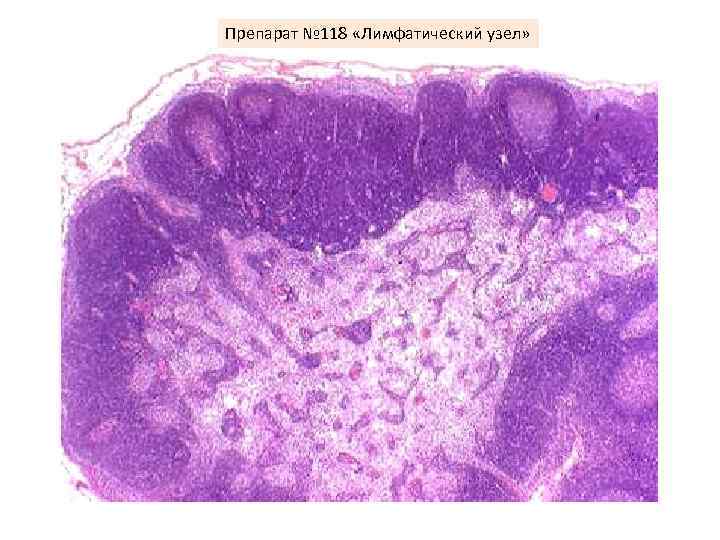 Препарат № 118 «Лимфатический узел» 