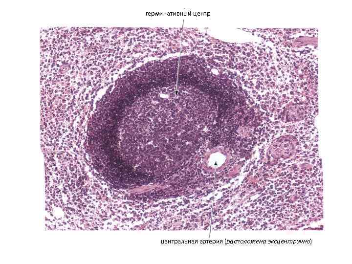 герминативный центральная артерия (расположена эксцентрично) 
