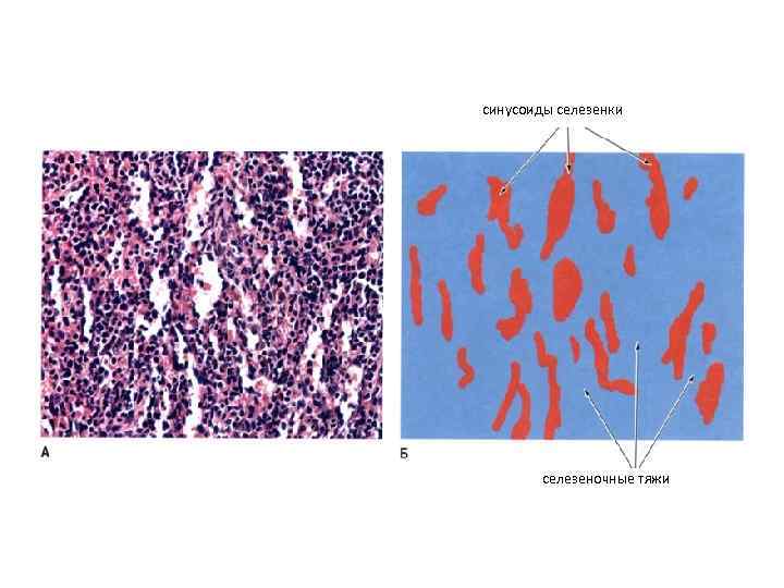 синусоиды селезенки селезеночные тяжи 