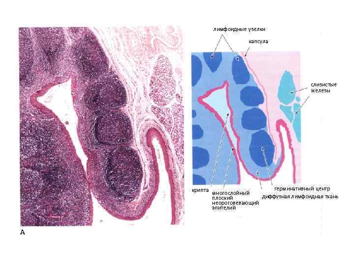 лимфоидные узелки капсула слизистые железы крипта герминативный центр многослойный диффузная лимфоидная ткань плоский неороговевающий