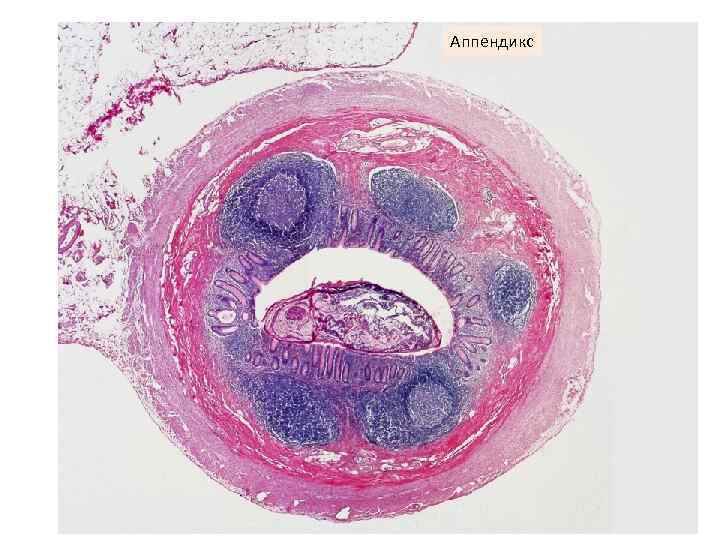 Аппендикс 
