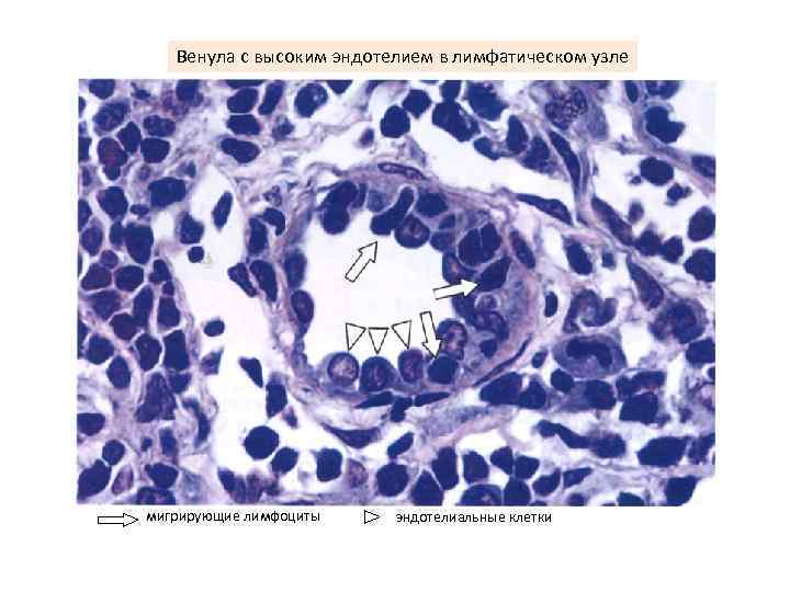 Венула с высоким эндотелием в лимфатическом узле мигрирующие лимфоциты эндотелиальные клетки 
