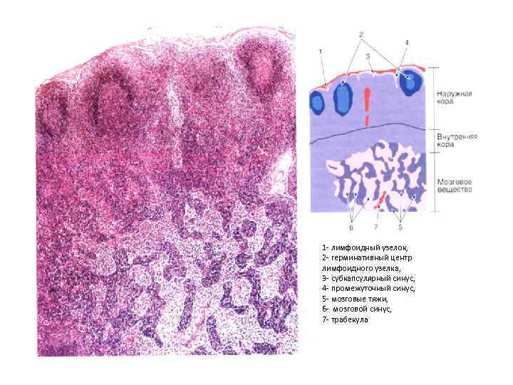 1 - лимфоидный узелок, 2 - герминативный центр лимфоидного узелка, 3 - субкапсулярный синус,