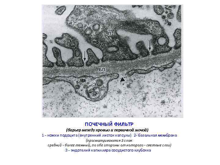 ПОЧЕЧНЫЙ ФИЛЬТР (барьер между кровью и первичной мочой) 1 - ножки подоцита (внутренний листок