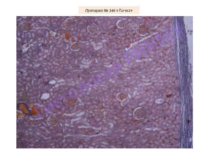 Препарат № 146 «Почка» У М И Н Р я ги о л о