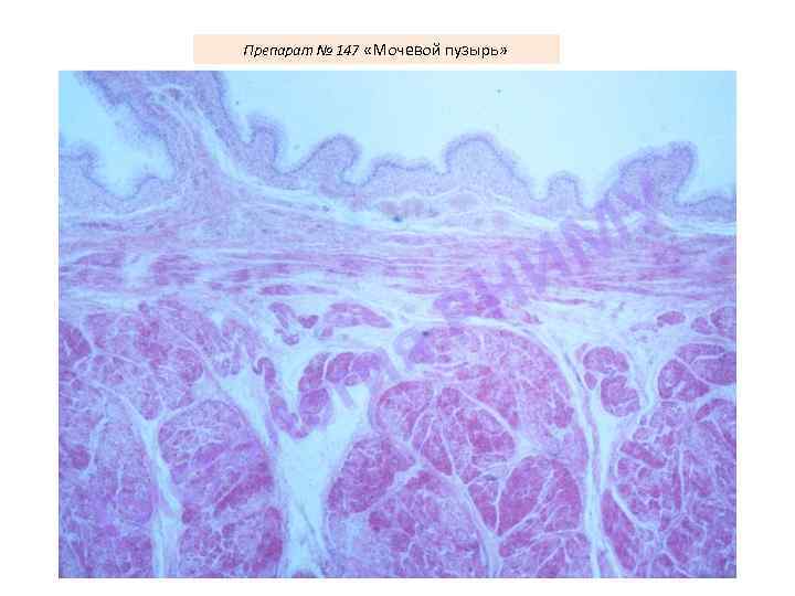 Препарат № 147 «Мочевой пузырь» У М И Н Р я ги о л