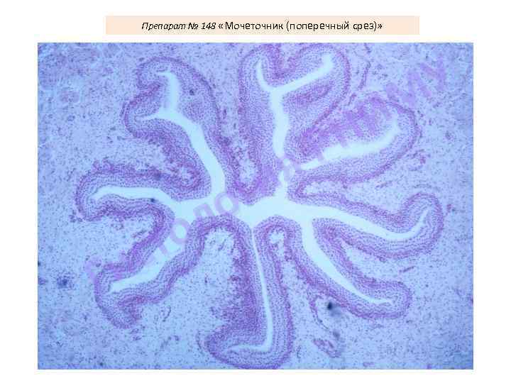 Препарат № 148 «Мочеточник (поперечный срез)» У М И Н Р я ги о