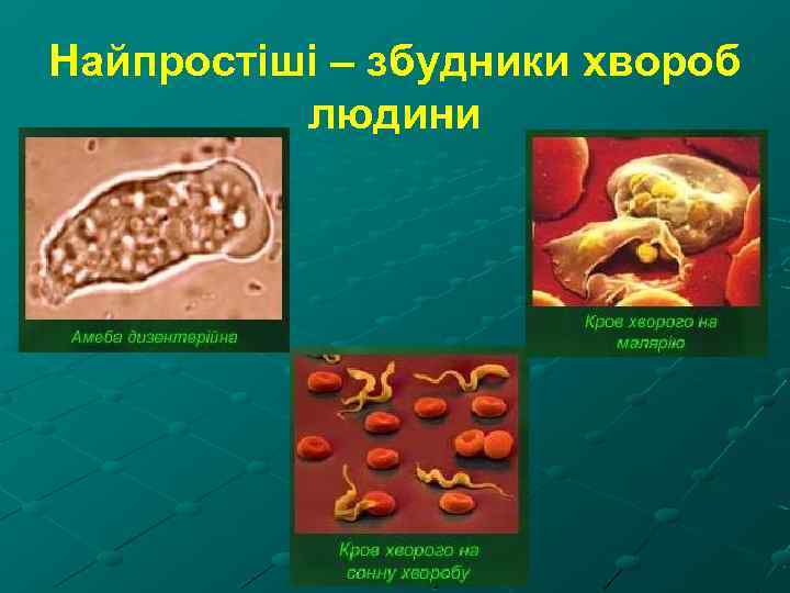 Найпростіші – збудники хвороб людини 