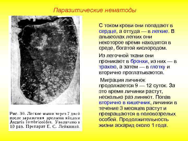 Паразитические нематоды С током крови они попадают в сердце, а оттуда — в легкие.