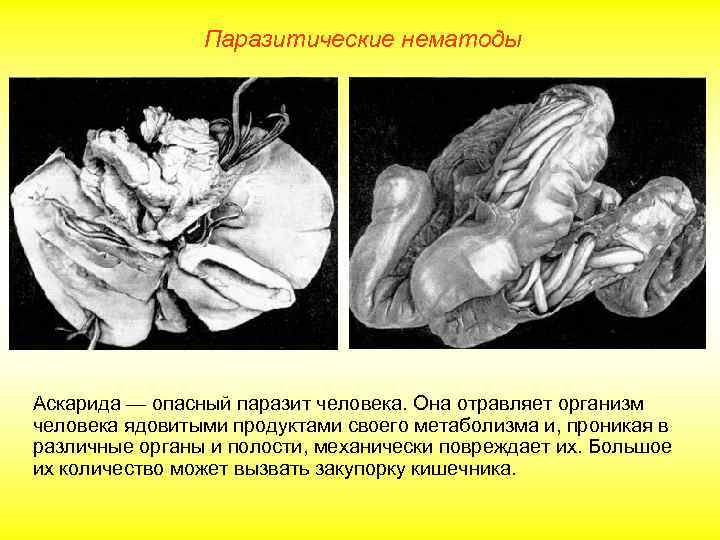 Паразитические нематоды Аскарида — опасный паразит человека. Она отравляет организм человека ядовитыми продуктами своего