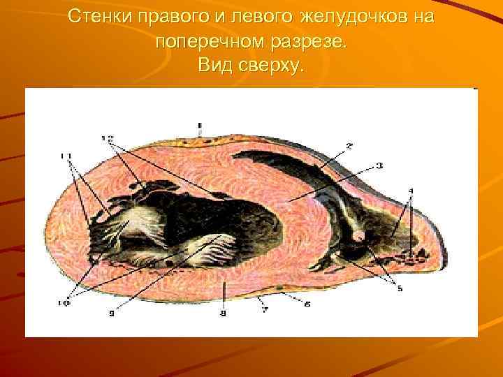 Стенки правого и левого желудочков на поперечном разрезе. Вид сверху. 