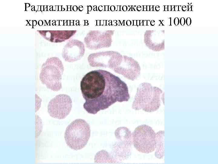 Радиальное расположение нитей хроматина в плазмоците х 1000 