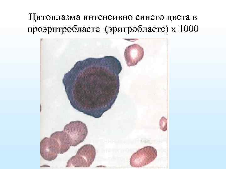 Цитоплазма интенсивно синего цвета в проэритробласте (эритробласте) х 1000 