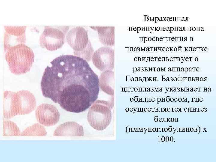Клетка с базофильной цитоплазмой. Перинуклеарная цитоплазма. Базофильная зона цитоплазмы. Клетки с выраженной базофилией цитоплазмы. Перинуклеарная зона просветления.