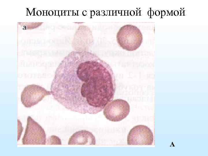 Моноциты с различной формой А 