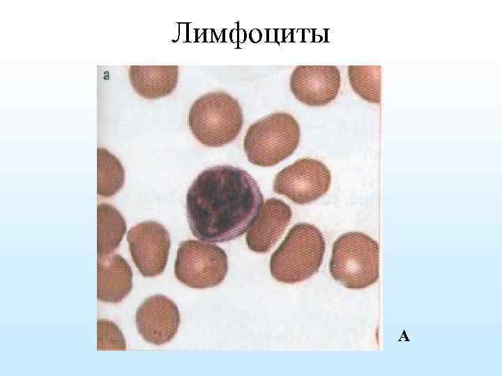 Лимфоциты А 