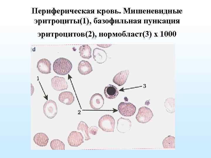 Нормобласты