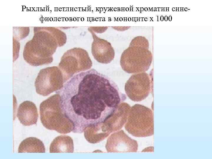 Рыхлый, петлистый, кружевной хроматин синефиолетового цвета в моноците х 1000 