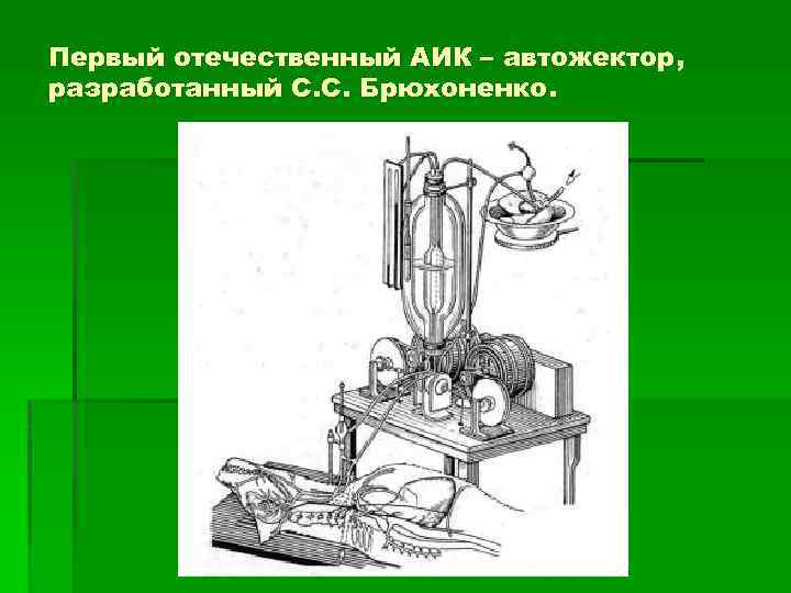 Первый отечественный АИК – автожектор, разработанный С. С. Брюхоненко. 