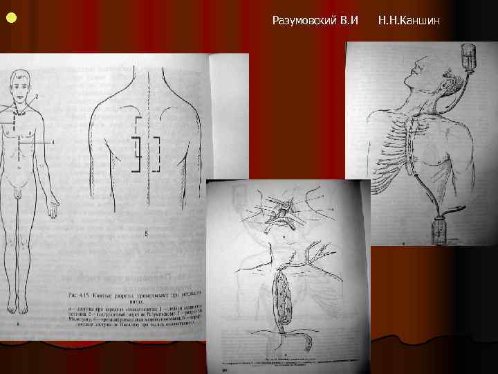 l Разумовский В. И Н. Н. Каншин 