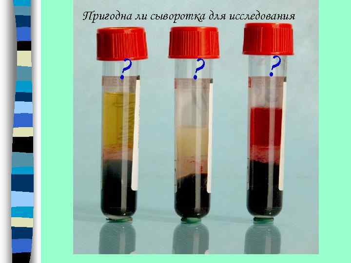 Пригодна ли сыворотка для исследования ? ? ? 