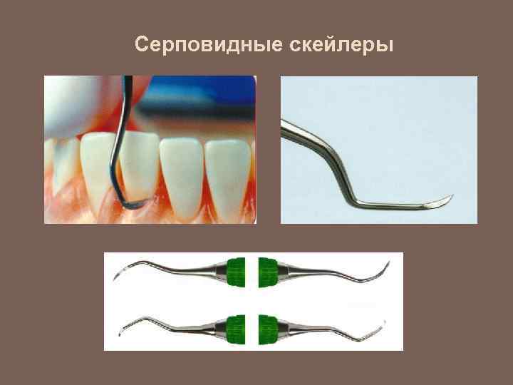 Серповидные скейлеры 