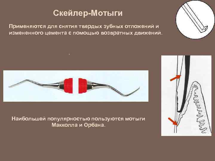 Скейлер-Мотыги Применяются для снятия твердых зубных отложений и измененного цемента с помощью возвратных движений.
