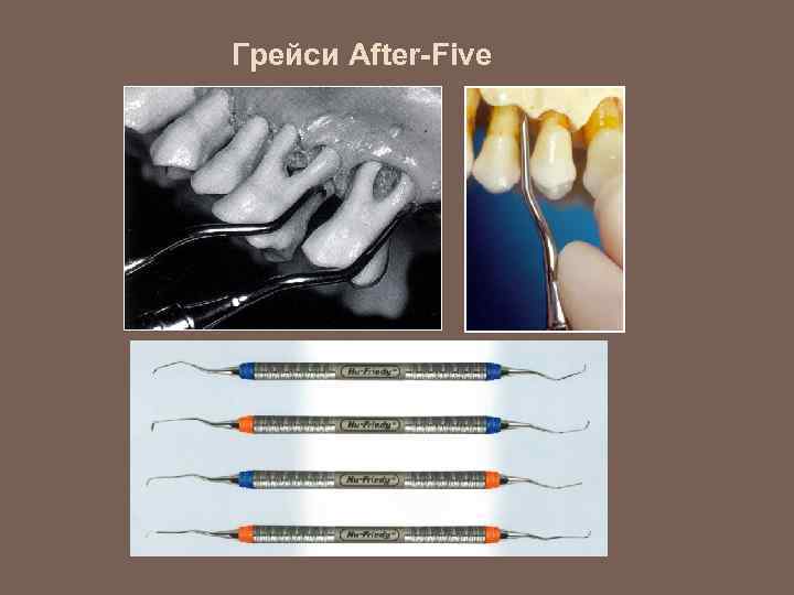 Грейси After-Five 