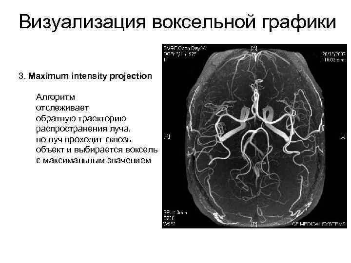 Интерактивная реконструкция кт изображений