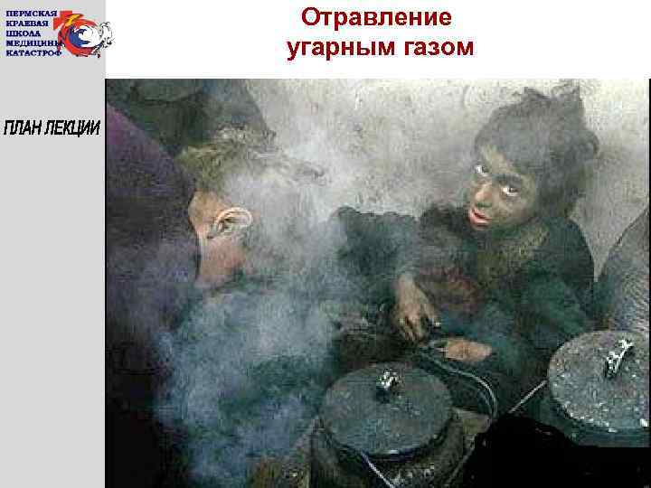 Отравление угарным газом 