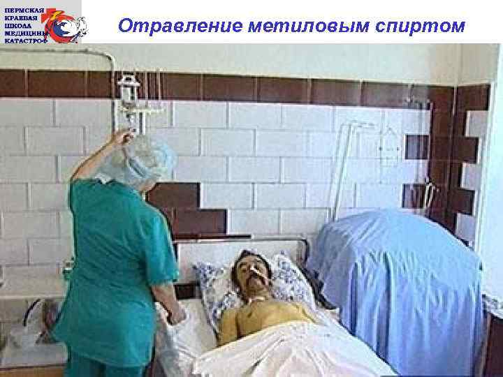 Отравление метиловым спиртом 
