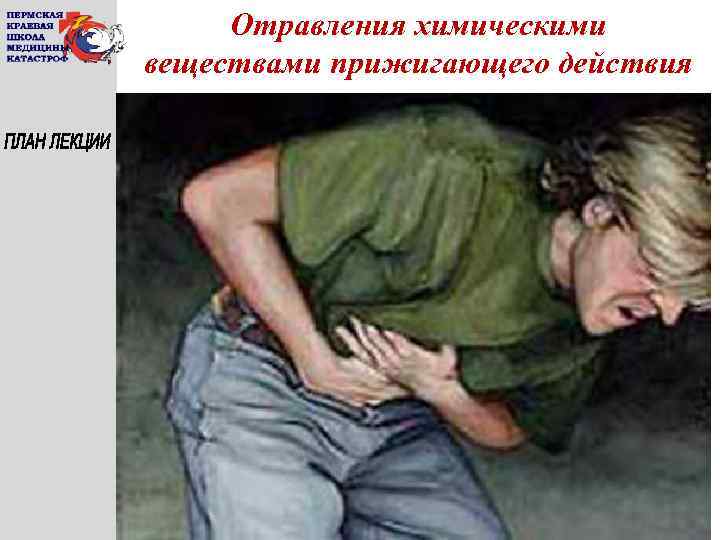 Отравления химическими веществами прижигающего действия 