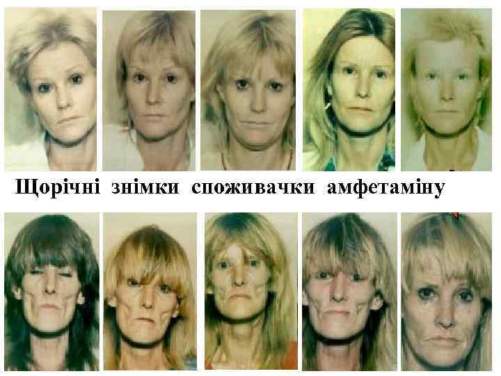 Щорічні знімки споживачки амфетаміну 