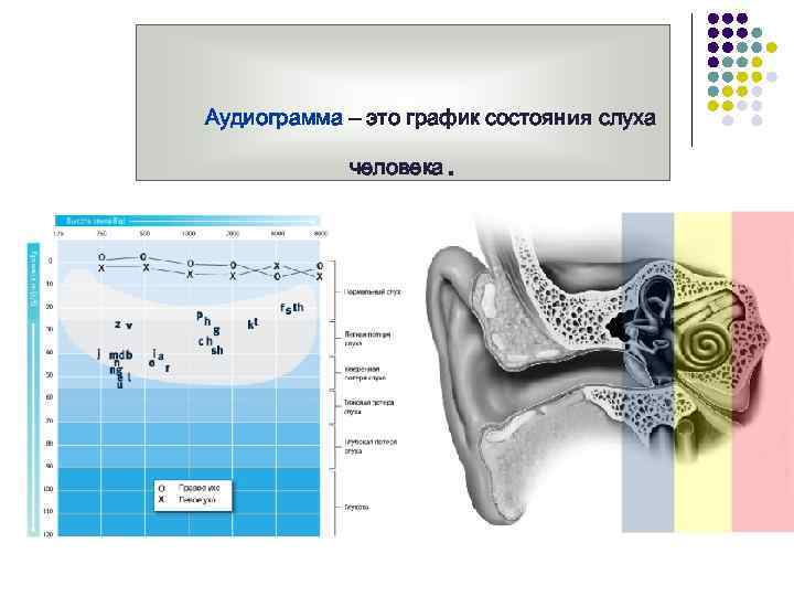 Аудиограмма – это график состояния слуха человека . 