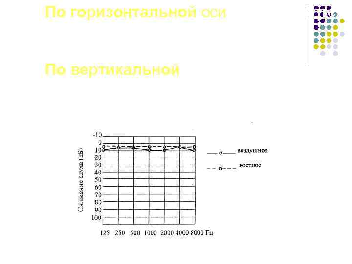 По горизонтальной оси откладываются частоты (от 125 до 8000 Гц) По вертикальной – пороги