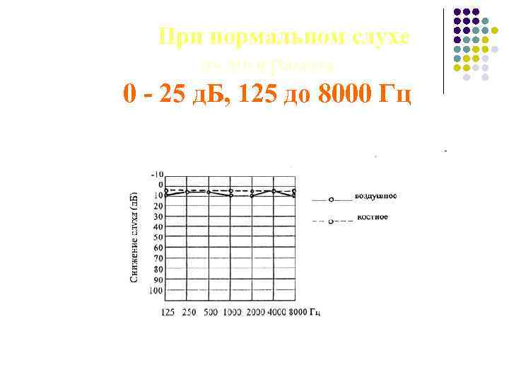 При нормальном слухе аудиограмма 0 - 25 д. Б, 125 до 8000 Гц 