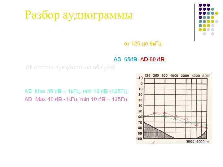 Разбор аудиограммы 1. Объем воспринимаемых частот -от 125 до 8 к. Гц 2. Интенсивность