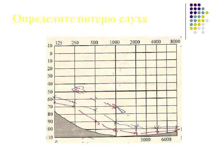 Определите потерю слуха 