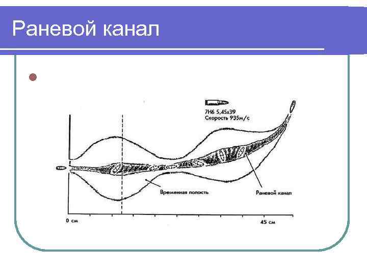 Схема раневого канала