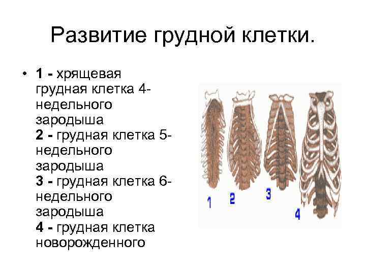 Развитие грудной клетки. • 1 - хрящевая грудная клетка 4 недельного зародыша 2 -