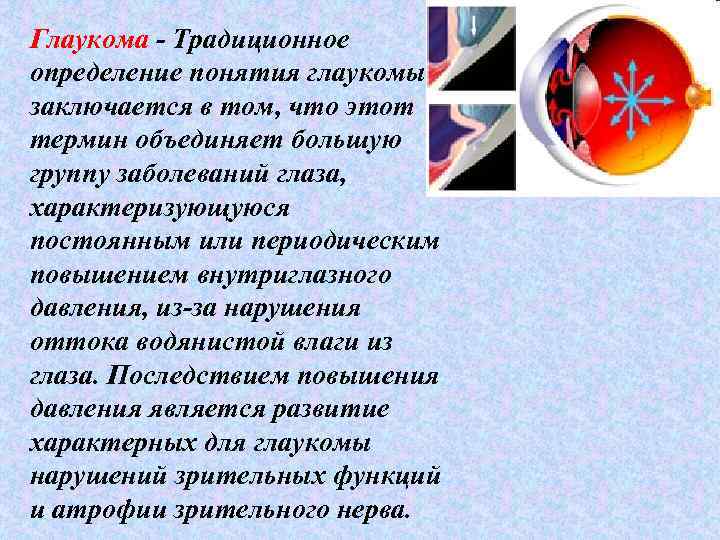 Глаукома - Традиционное определение понятия глаукомы заключается в том, что этот термин объединяет большую