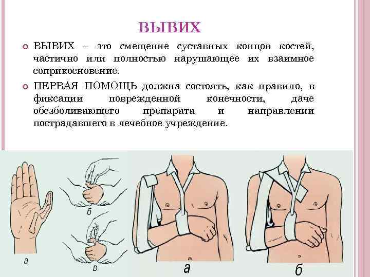 ВЫВИХ – это смещение суставных концов костей, частично или полностью нарушающее их взаимное соприкосновение.