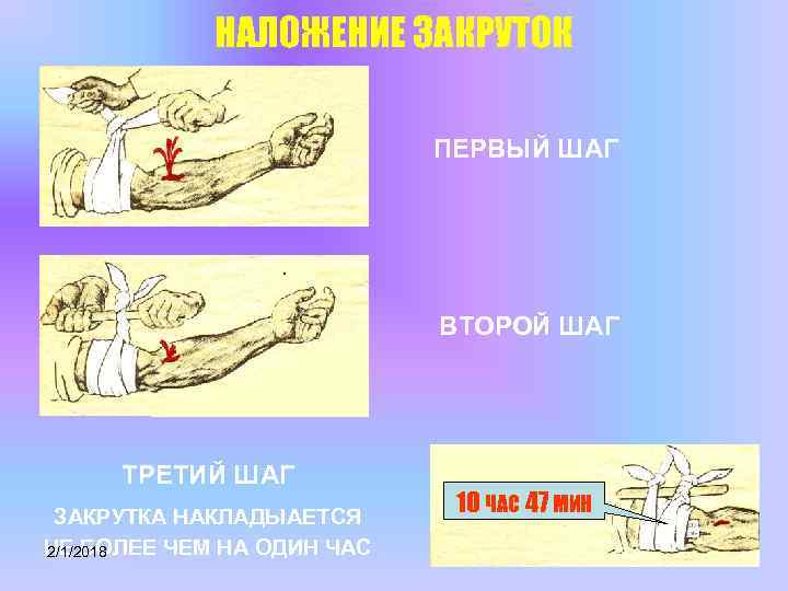 НАЛОЖЕНИЕ ЗАКРУТОК ПЕРВЫЙ ШАГ ВТОРОЙ ШАГ ТРЕТИЙ ШАГ ЗАКРУТКА НАКЛАДЫАЕТСЯ НЕ БОЛЕЕ ЧЕМ НА